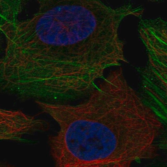 Anti-PHOSPHO1 antibody produced in rabbit