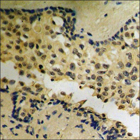 Anti-phospho-Akt (pThr<sup>72</sup>) antibody produced in rabbit