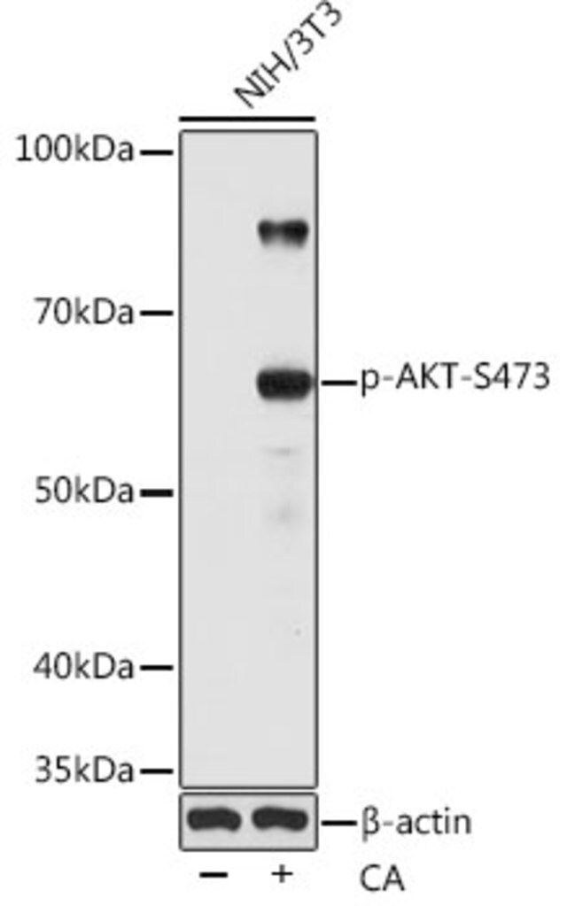 Anti-Phospho-AKT1-S473 antibody produced in rabbit