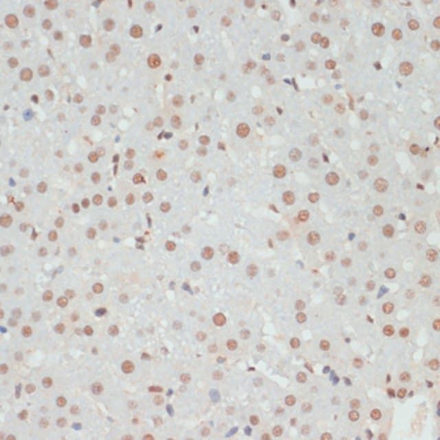 Anti-Phospho-AKT1S1-T246 antibody produced in rabbit