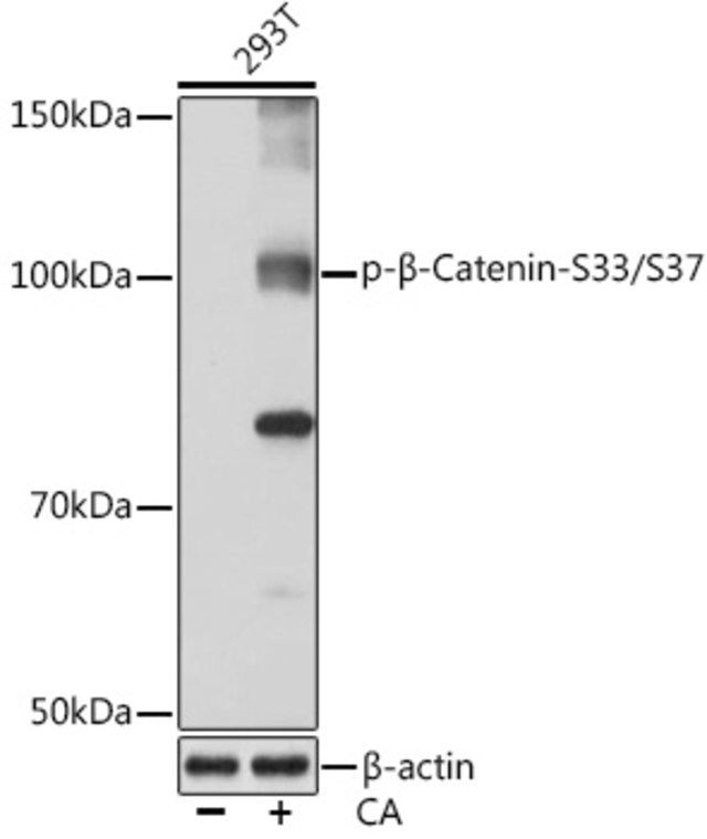 Anti-Phospho-β-Catenin-S33/S37 antibody produced in rabbit