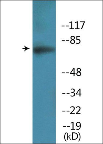 Anti-phospho-Artemis (pSer<sup>516</sup>) antibody produced in rabbit