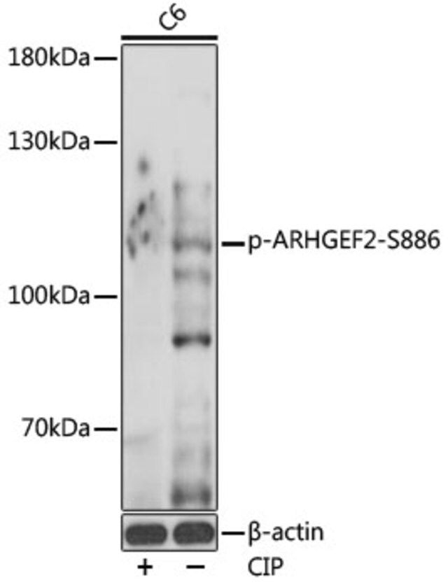 Anti-Phospho-ARHGEF2-S886 antibody produced in rabbit