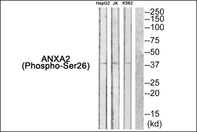 Anti-phospho-ANXA2 (pSer<sup>26</sup>) antibody produced in rabbit
