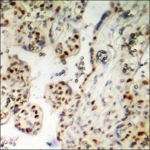 Anti-phospho-AML1 (pSer<sup>303</sup>) antibody produced in rabbit