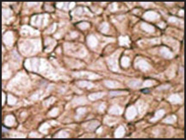 Anti-PDX1 (N-term) antibody produced in rabbit