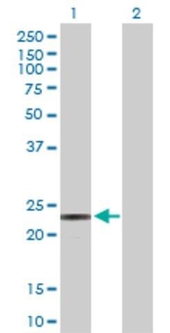 Anti-PEMT antibody produced in rabbit