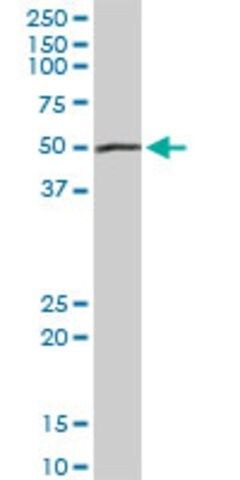 Anti-PEPD antibody produced in rabbit