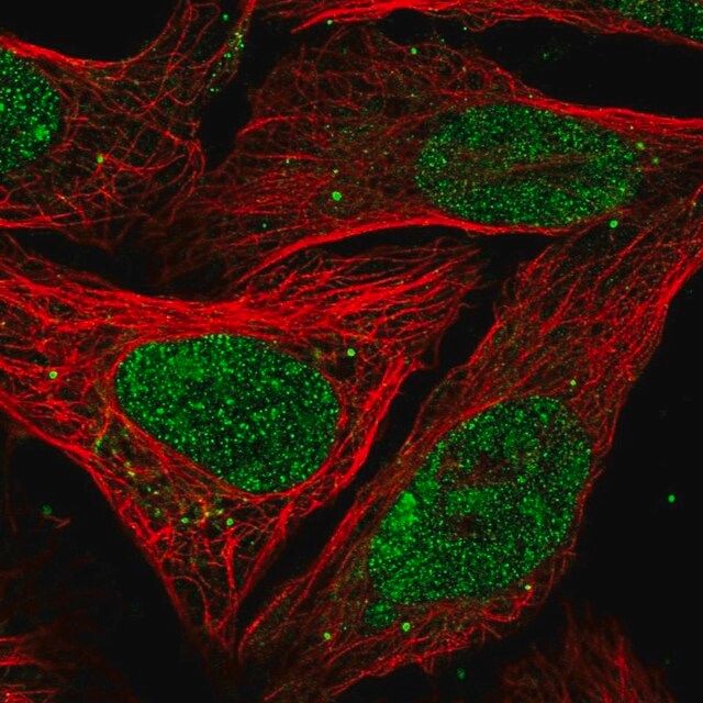 Anti-PELP1 antibody produced in rabbit