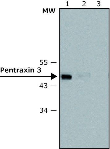 Anti-Pentraxin 3 antibody, Mouse monoclonal