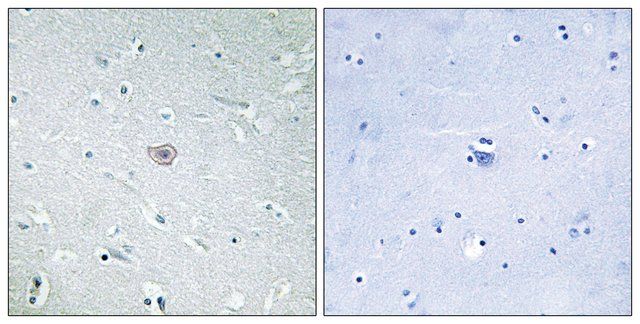 Anti-PE2R3 antibody produced in rabbit