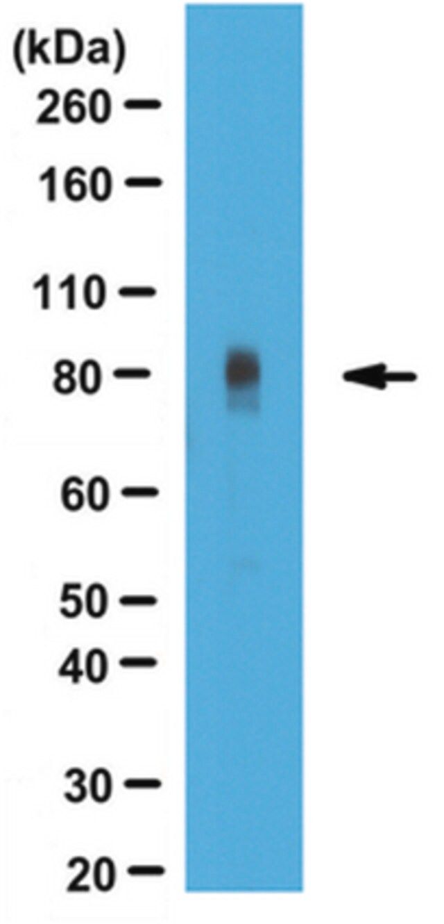 Anti-Periostin Antibody (C-term)