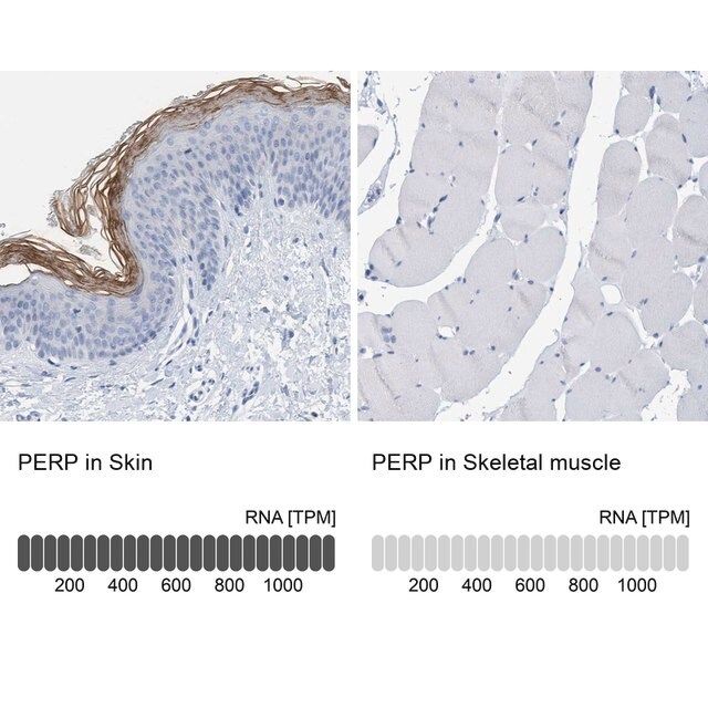 Anti-PERP antibody produced in rabbit