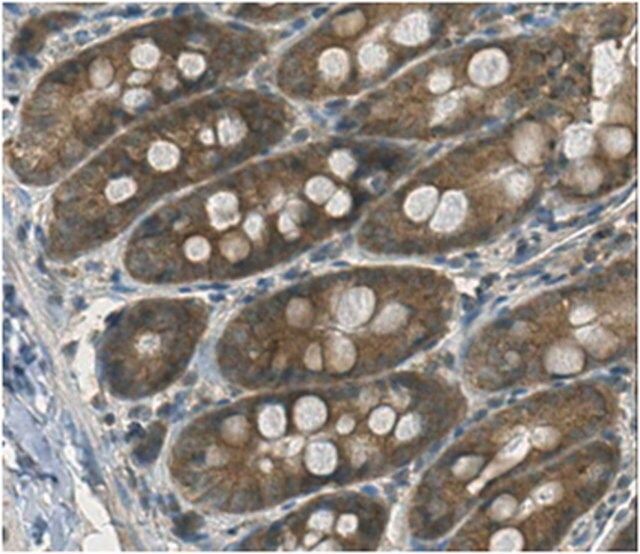 Anti-Peptide YY Antibody