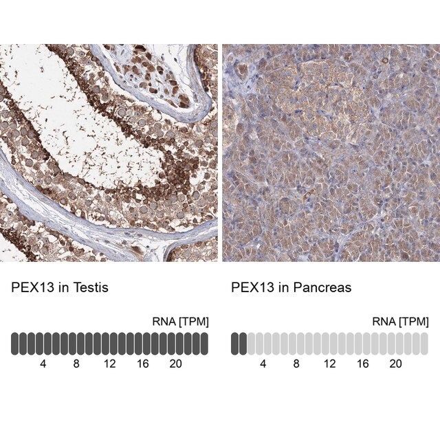 Anti-PEX13 antibody produced in rabbit
