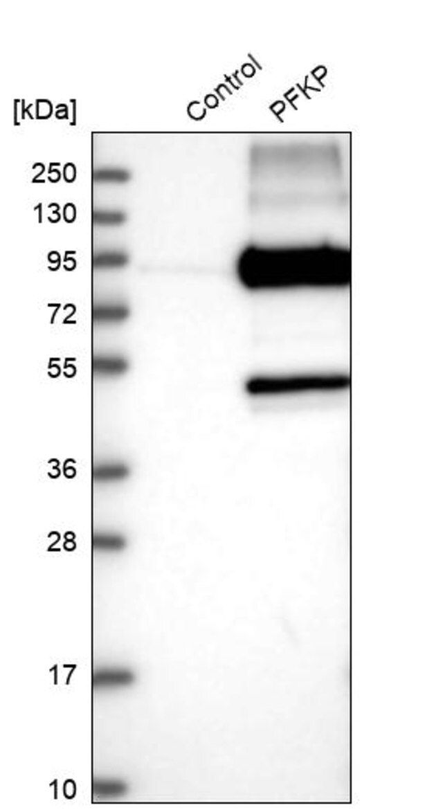 Anti-PFKP antibody produced in rabbit
