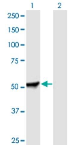 Anti-PFKFB2 antibody produced in mouse