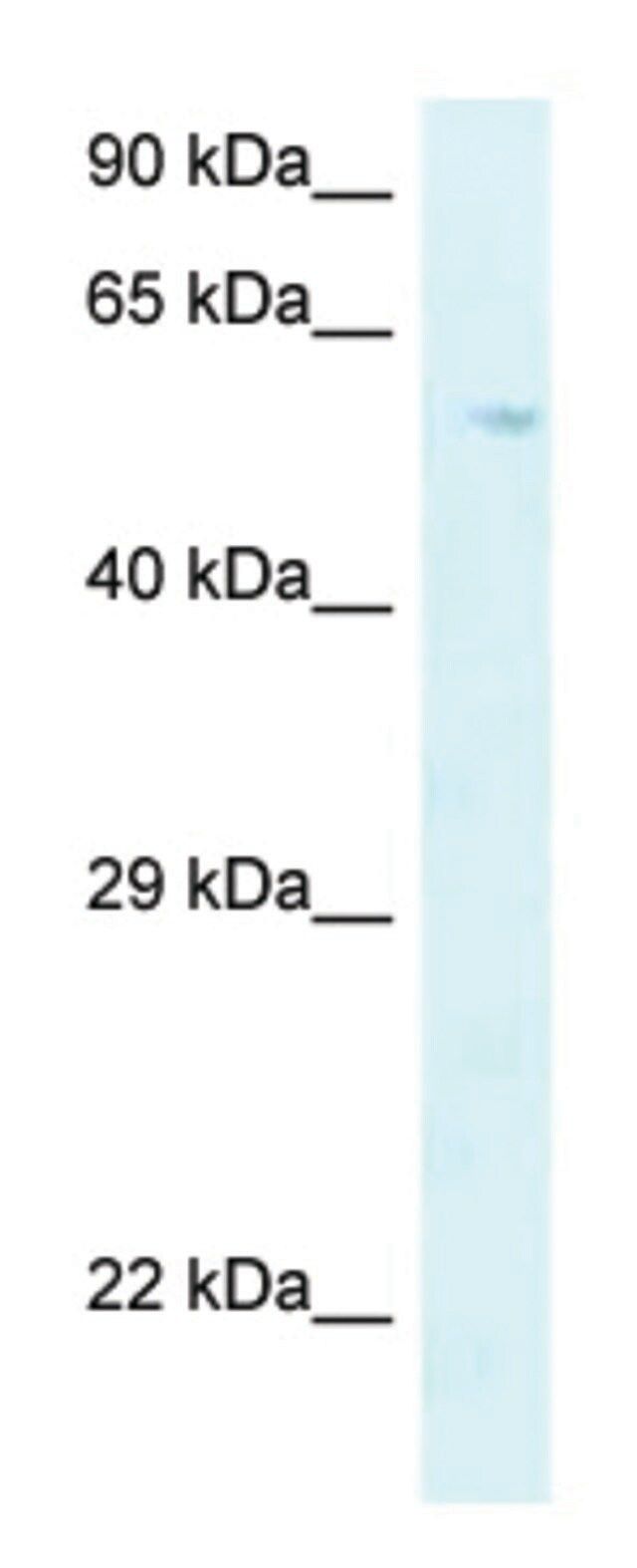 Anti-P4HA2 (C-terminal) antibody produced in rabbit