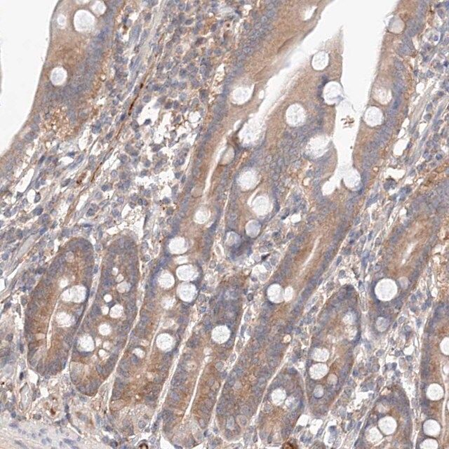 Anti-PGGT1B antibody produced in rabbit