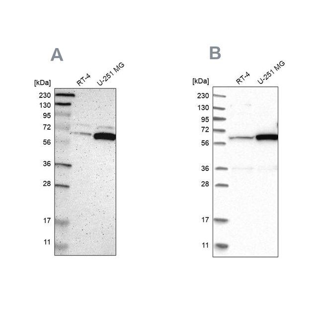 Anti-P4HA1 antibody produced in rabbit