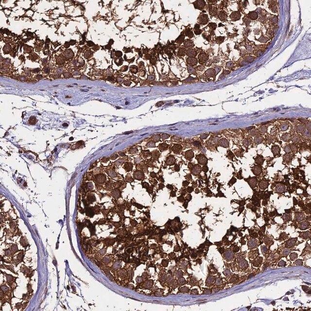 Anti-PGPEP1L antibody produced in rabbit