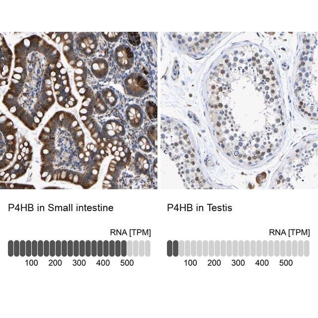 Anti-P4HB antibody produced in rabbit