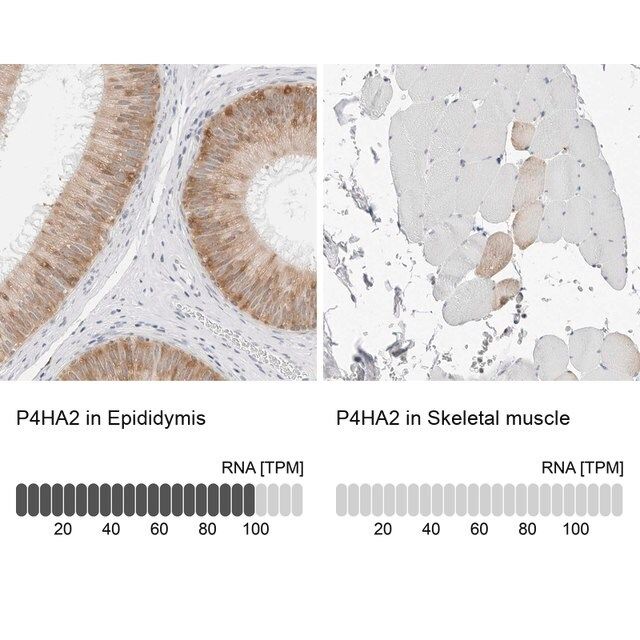 Anti-P4HA2 antibody produced in rabbit