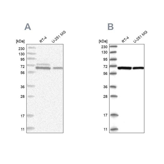 Anti-PGM3 antibody produced in rabbit