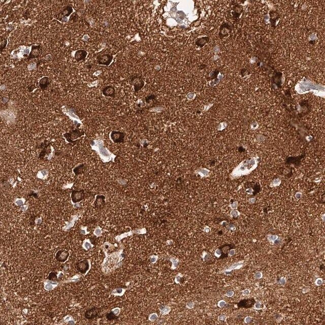 Anti-PHACTR1 antibody produced in rabbit