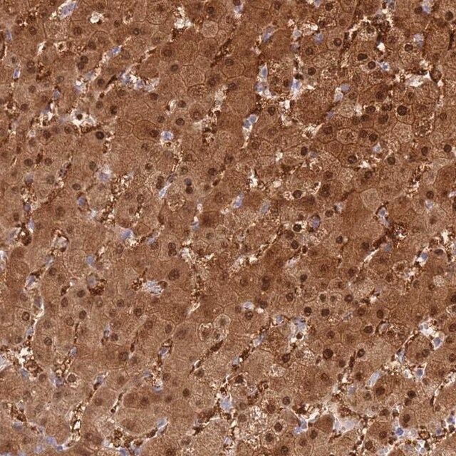 Anti-PGM1 antibody produced in rabbit