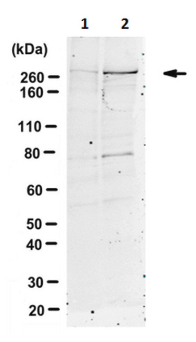 Anti-phospho ATM/ATR (Thr1989) Antibody