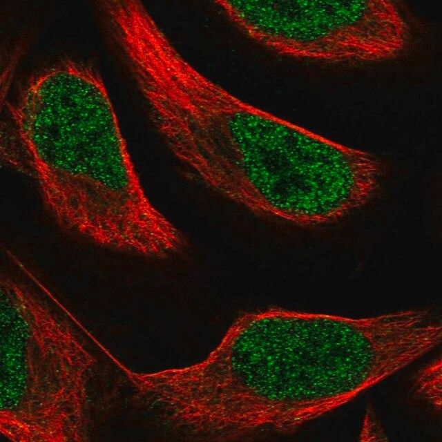 Anti-PAX8 antibody produced in rabbit