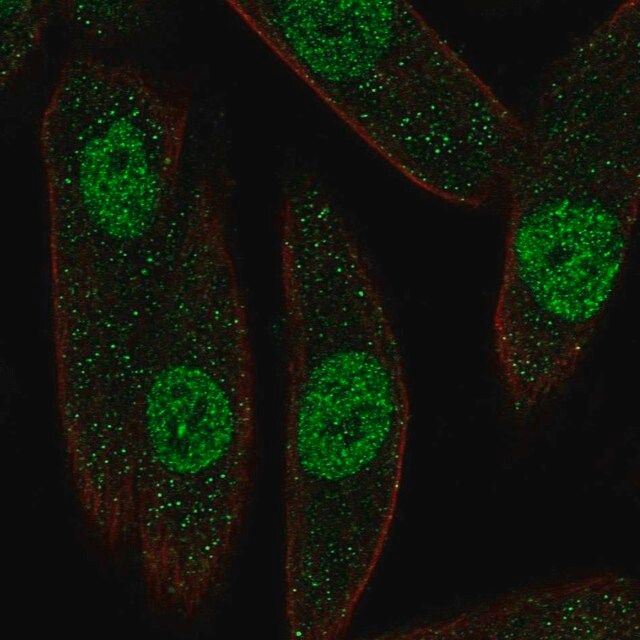 Anti-PAX8 antibody produced in rabbit
