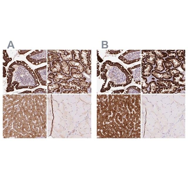 Anti-PCK2 antibody produced in rabbit