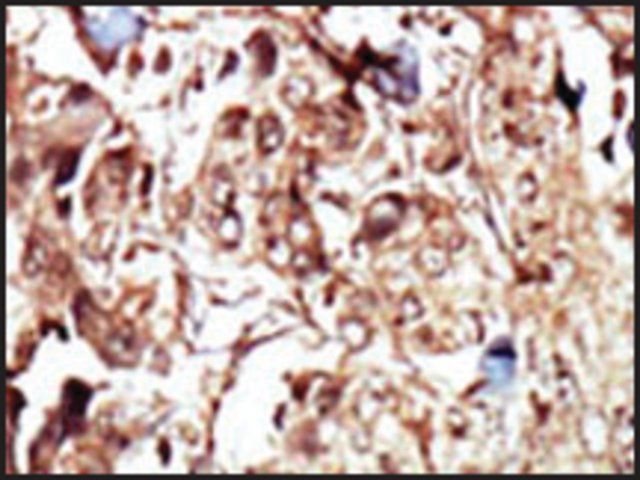 Anti-PCK2 (N-term) antibody produced in rabbit