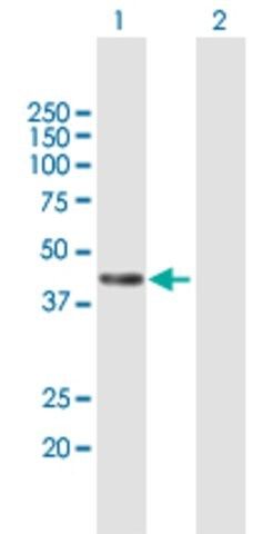 Anti-PCMTD1 antibody produced in mouse