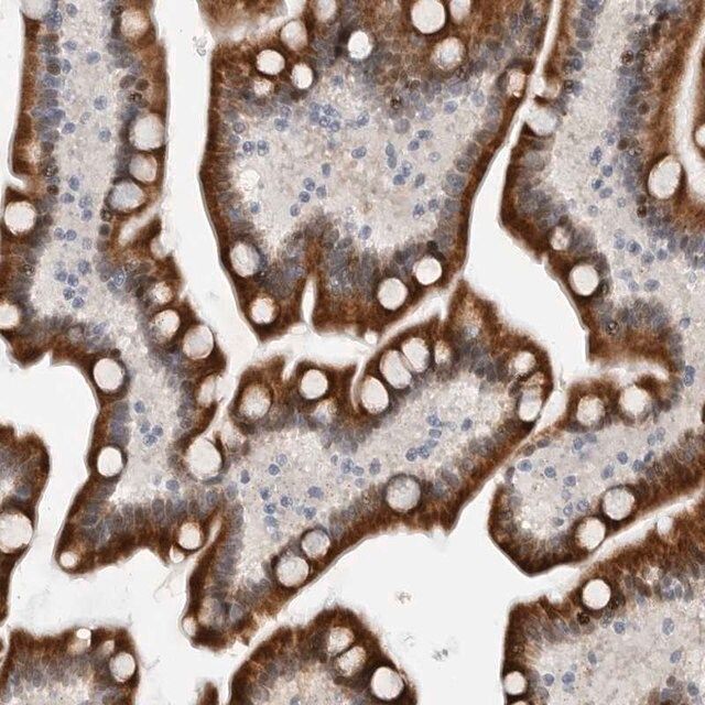 Anti-PCMTD1 antibody produced in rabbit