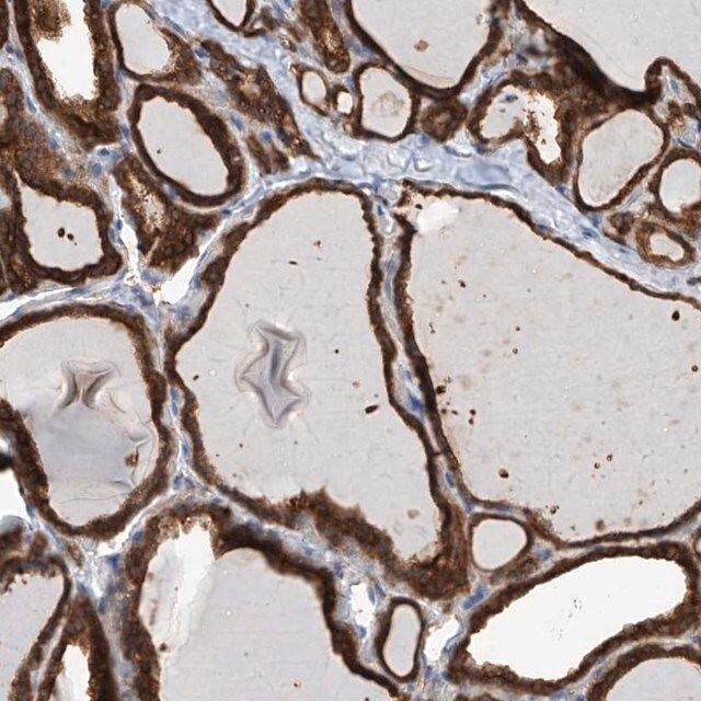 Anti-OR4K1 antibody produced in rabbit