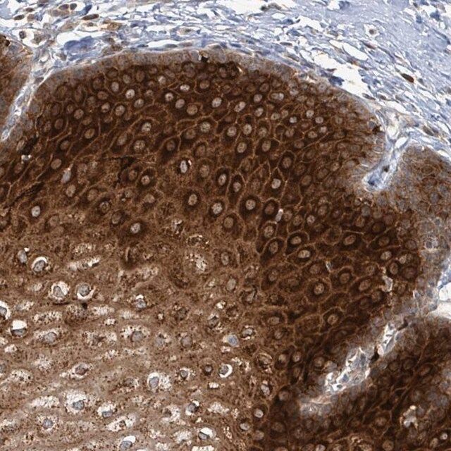 Anti-OR51E1 antibody produced in rabbit