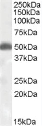 Anti-Orexin Receptor 2 antibody produced in goat