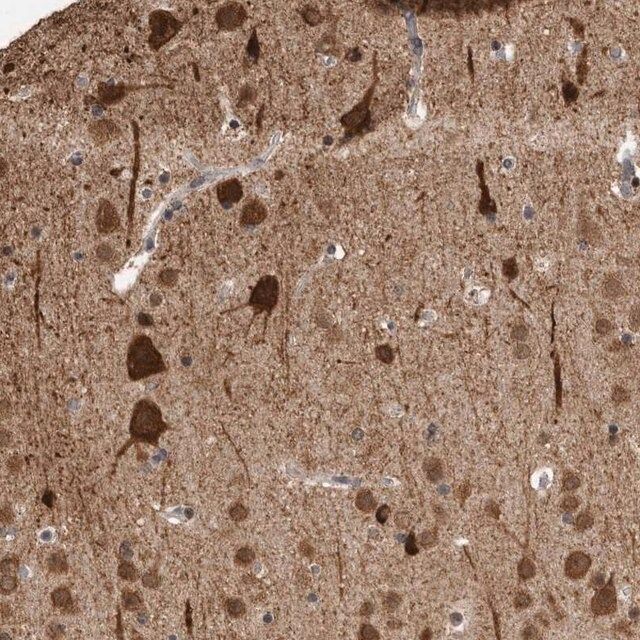 Anti-OR2K2 antibody produced in rabbit
