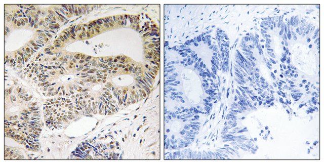 Anti-OSR1 antibody produced in rabbit