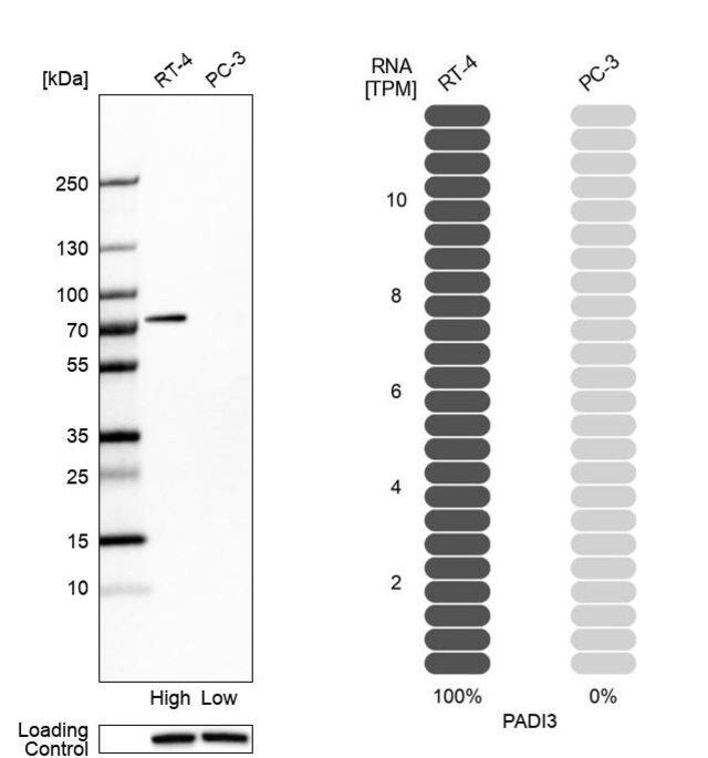 Anti-PADI3 antibody produced in rabbit