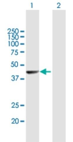 Anti-NR2E1 antibody produced in mouse
