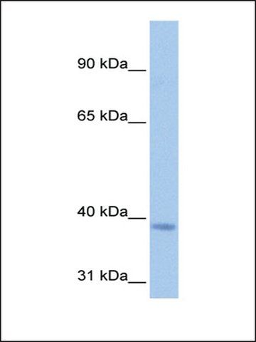 Anti-NSUN3 antibody produced in rabbit