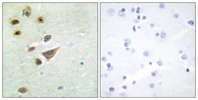 Anti-NT5C3 antibody produced in rabbit