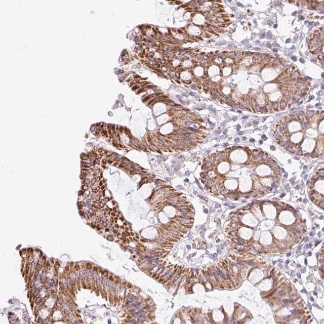 Anti-NT5C1B antibody produced in rabbit