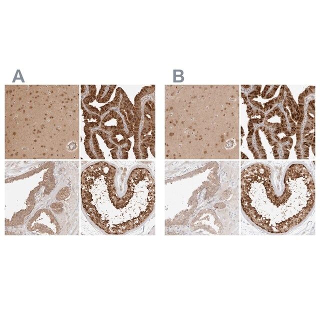 Anti-NUDC antibody produced in rabbit