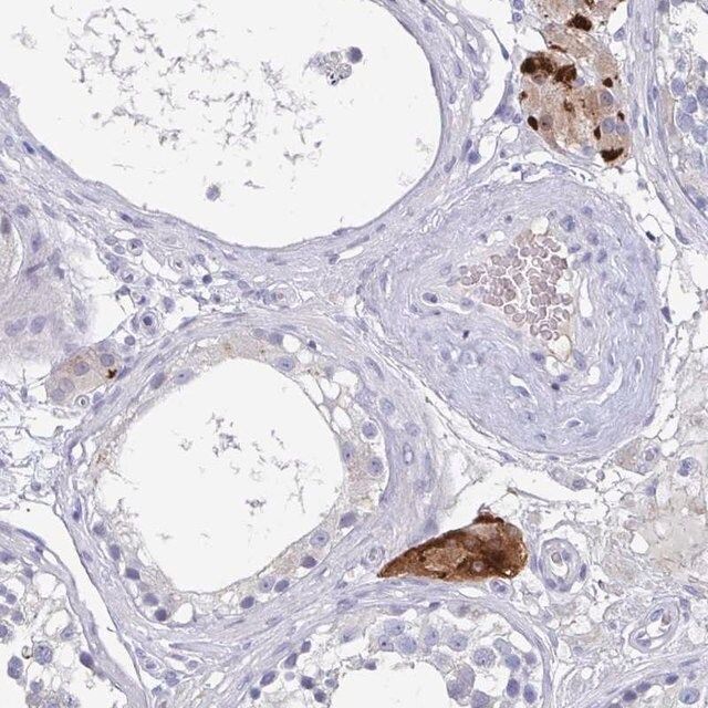 Anti-NT5C3B antibody produced in rabbit
