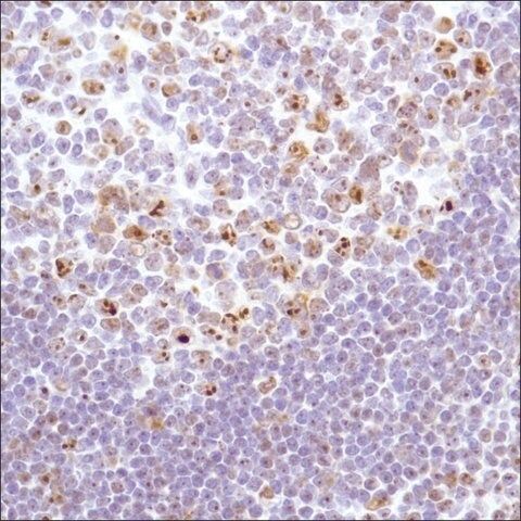 Anti-Nucleophosmin antibody, Rabbit monoclonal